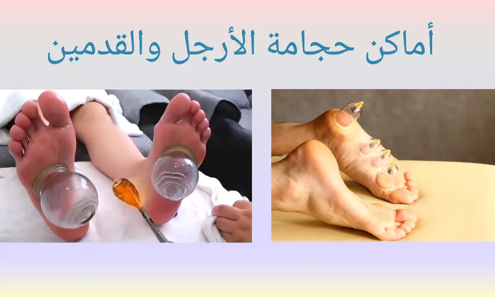 افضل اماكن الحجامة بالجسم بالصور 5 افضل اماكن الحجامة بالجسم